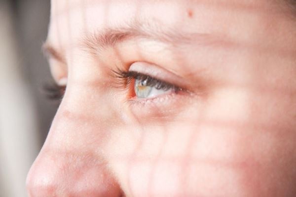 Почему появляются темные круги под глазами: ответ дерматолога