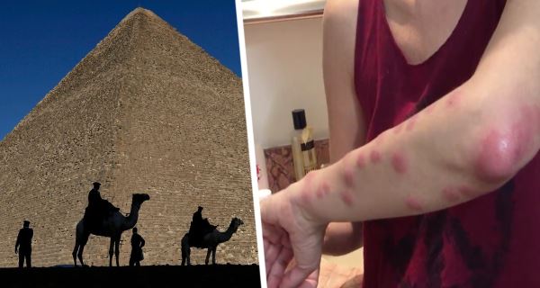 Клопы добрались до курортов Египта: в Хургаде из-за них отравились туристы